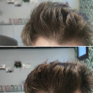 Prima e dopo | Trattamenti da HeadSpa