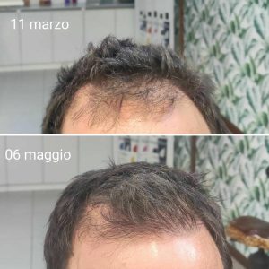 Prima e dopo | Trattamenti da HeadSpa