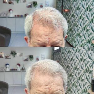 Prima e dopo | Trattamenti da HeadSpa
