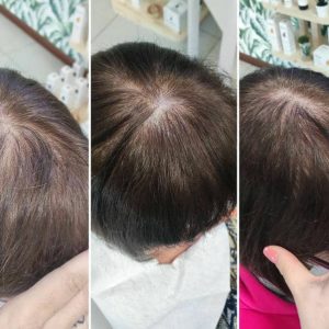 Prima e dopo | Trattamenti da HeadSpa