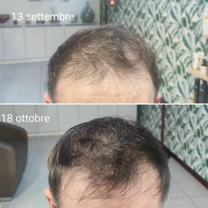 Prima e dopo | Trattamenti da HeadSpa