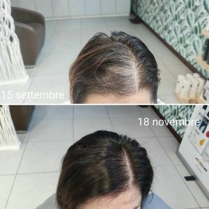 Prima e dopo | Trattamenti da HeadSpa