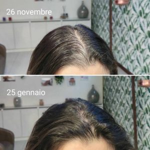 Prima e dopo | Trattamenti da HeadSpa