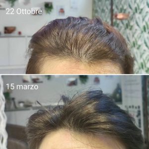 Prima e dopo | Trattamenti da HeadSpa