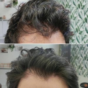 Prima e dopo | Trattamenti da HeadSpa