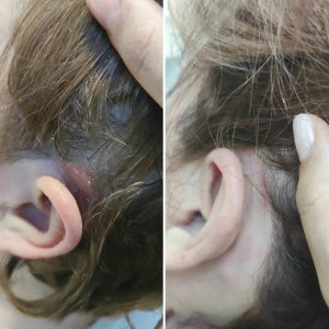 Prima e dopo | Trattamenti da HeadSpa