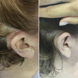 Prima e dopo | Trattamenti da HeadSpa