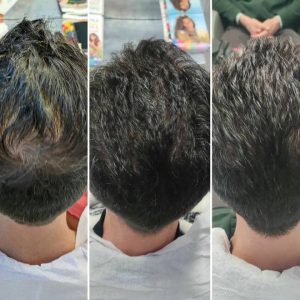 Prima e dopo | Trattamenti da HeadSpa
