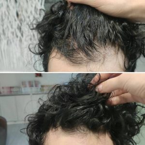 Prima e dopo | Trattamenti da HeadSpa