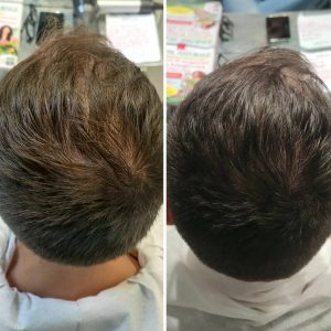Prima e dopo | Trattamenti da HeadSpa