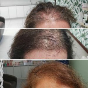 Prima e dopo | Trattamenti da HeadSpa